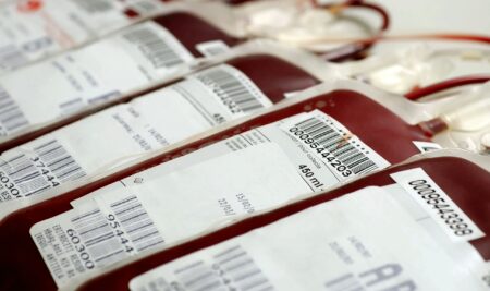 Iptacopán, primer tratamiento oral en monoterapia para la hemoglobinuria paroxística nocturna