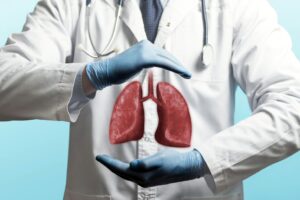 Imagen nota cáncer de pulmón microcítico
